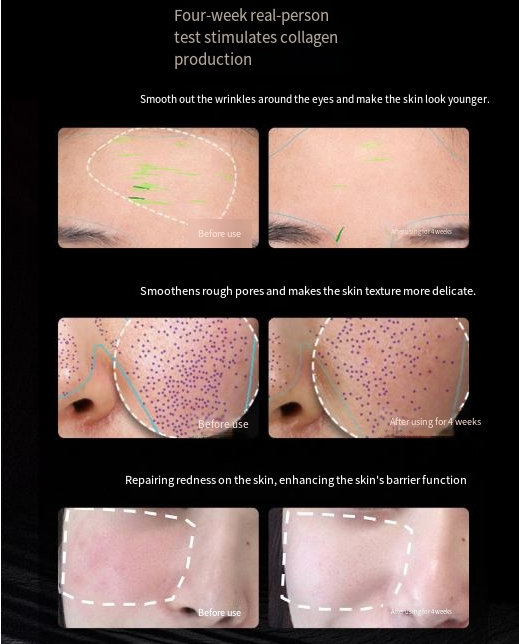 IPL Photon Skin Rejuvenation Beauty Mask Device